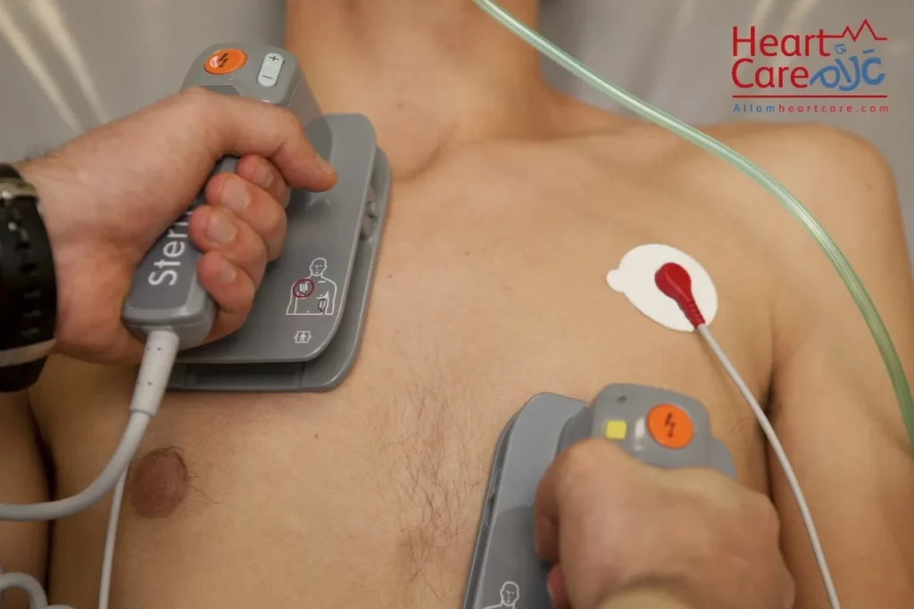 تجربتي مع كهرباء القلب | علاج كهرباء القلب بالصدمة الكهربية