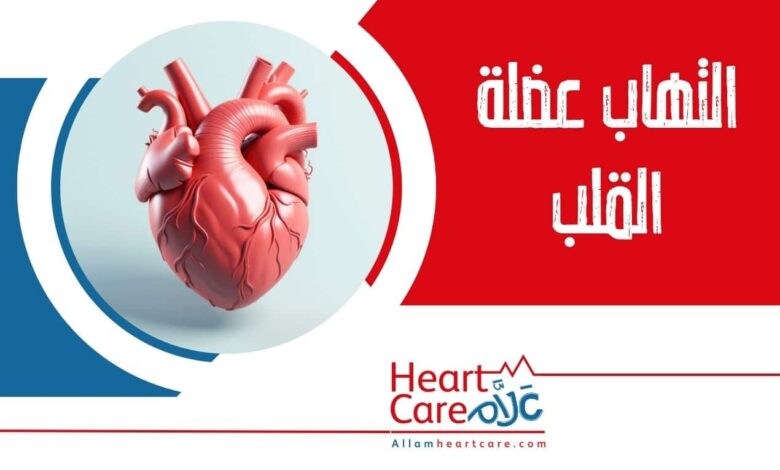 التهاب عضلة القلب