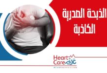 الذبحة الصدرية الكاذبة