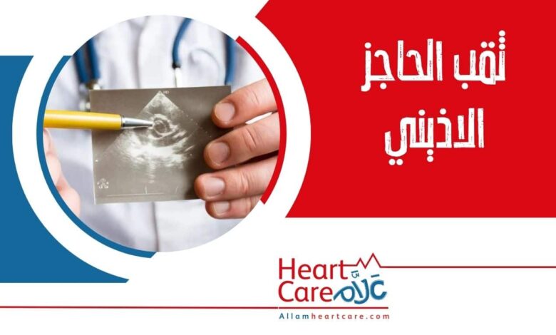 ثقب الحاجز الاذيني